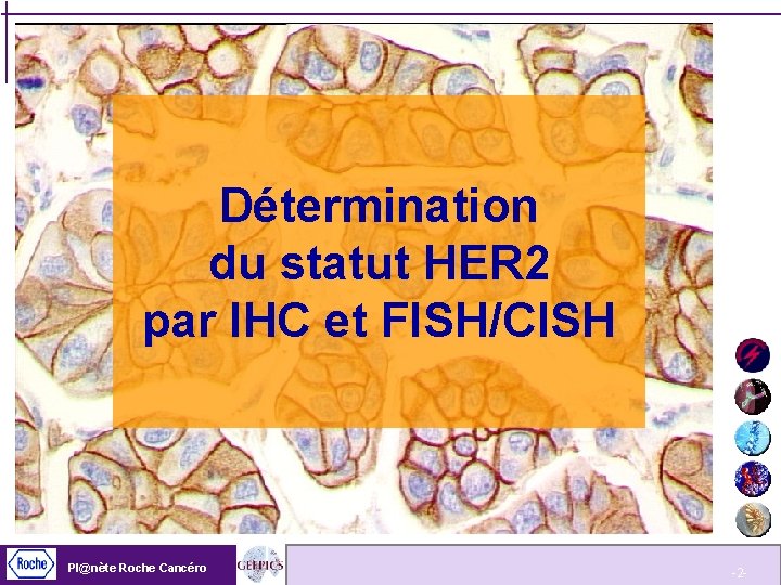 Détermination du statut HER 2 par IHC et FISH/CISH Pl@nète Roche Cancéro -2 -