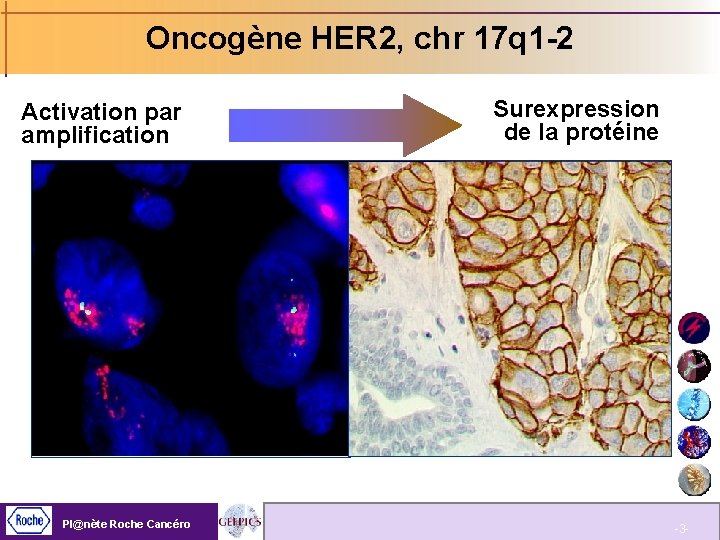 Oncogène HER 2, chr 17 q 1 -2 Activation par amplification Pl@nète Roche Cancéro