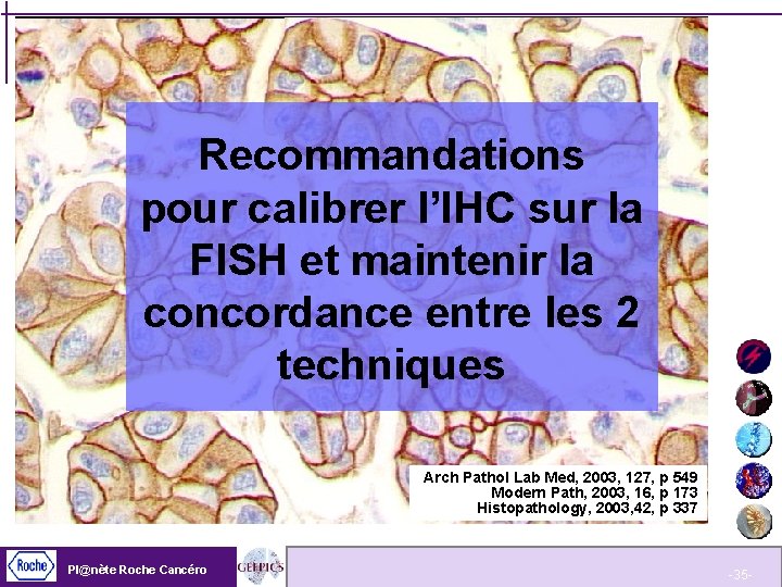 Recommandations pour calibrer l’IHC sur la FISH et maintenir la concordance entre les 2