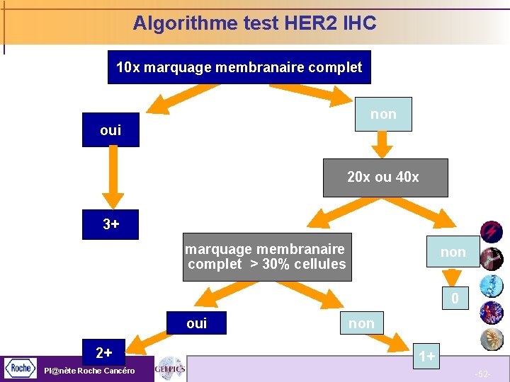 Algorithme test HER 2 IHC 10 x marquage membranaire complet non oui 20 x