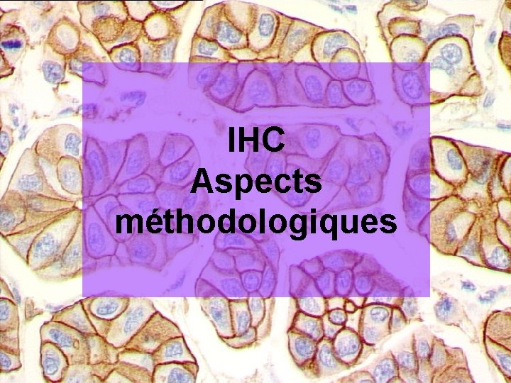 IHC Aspects méthodologiques Pl@nète Roche Cancéro -55 - 