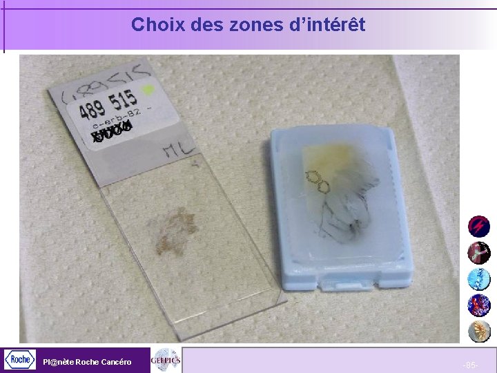 Choix des zones d’intérêt Pl@nète Roche Cancéro -85 - 