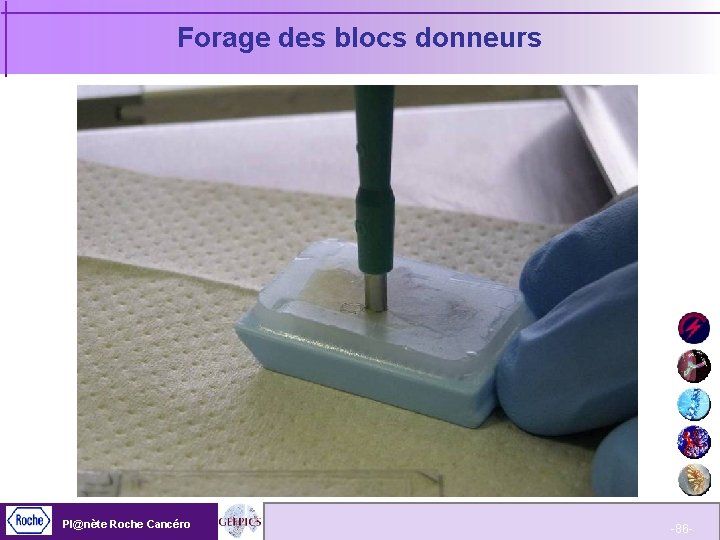 Forage des blocs donneurs Pl@nète Roche Cancéro -86 - 