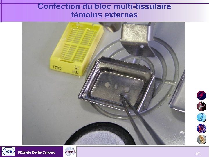 Confection du bloc multi-tissulaire témoins externes Pl@nète Roche Cancéro -87 - 
