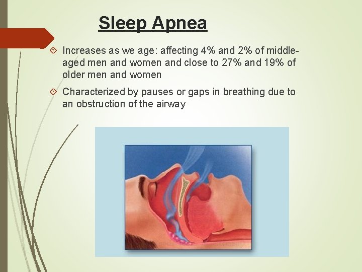 Sleep Apnea Increases as we age: affecting 4% and 2% of middleaged men and