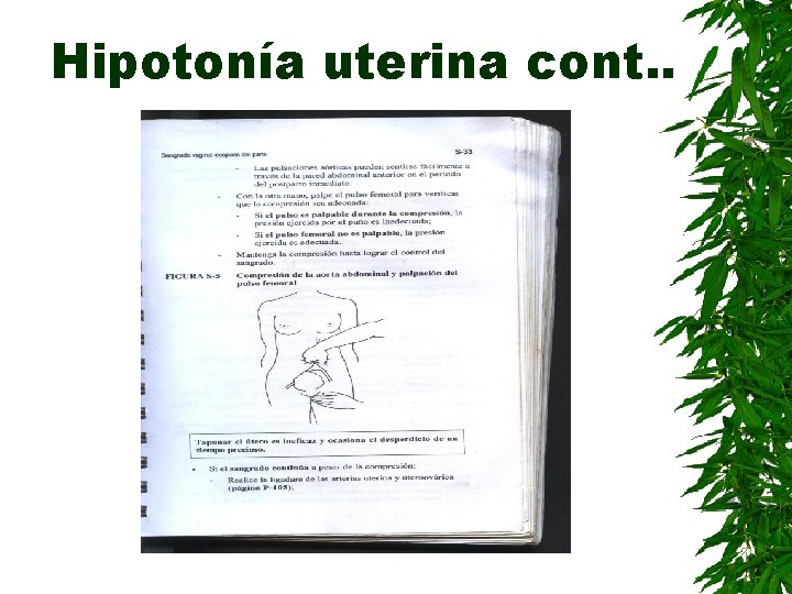 Hipotonía uterina cont. . 