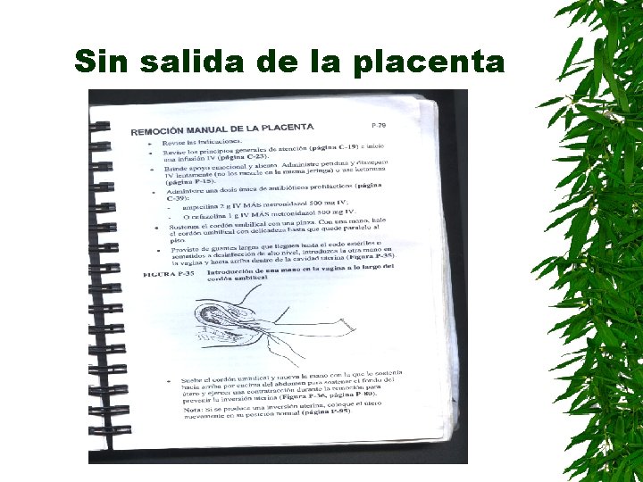 Sin salida de la placenta 