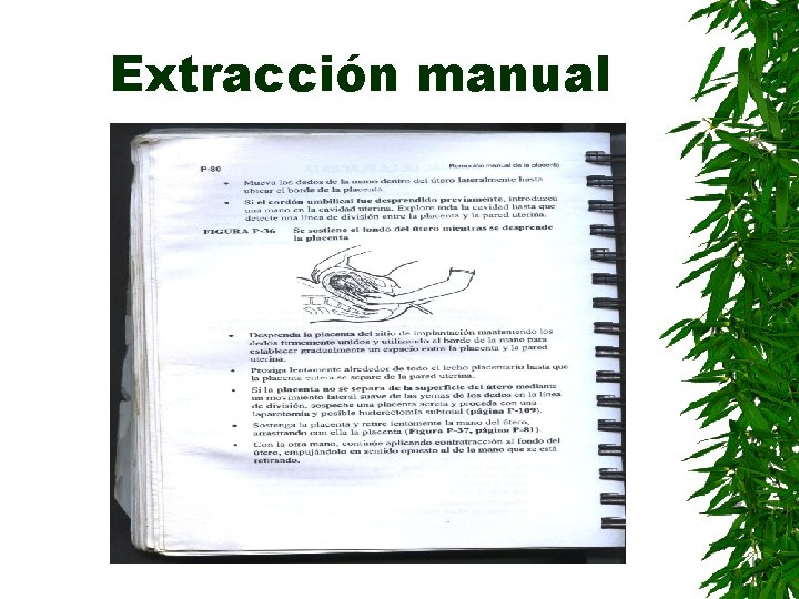 Extracción manual 