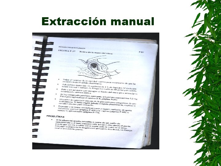 Extracción manual 
