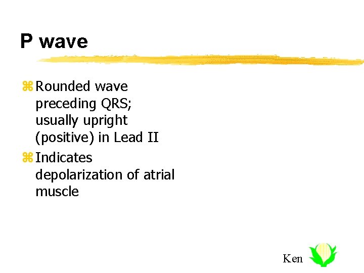 P wave z Rounded wave preceding QRS; usually upright (positive) in Lead II z