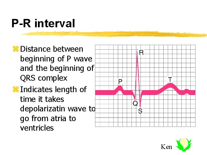 P-R interval z Distance between beginning of P wave and the beginning of QRS