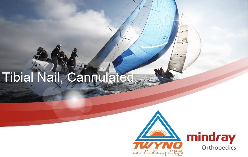 Tibial Nail, Cannulated 