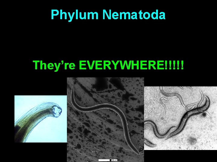 Phylum Nematoda The round worms They’re EVERYWHERE!!!!! 