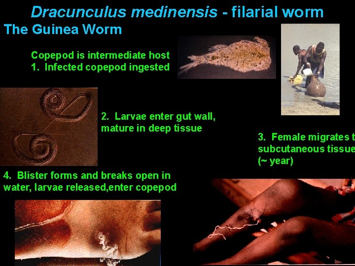 Dracunculus medinensis - filarial worm The Guinea Worm Copepod is intermediate host 1. Infected