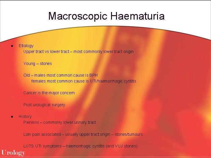 Macroscopic Haematuria l Etiology Upper tract vs lower tract – most commonly lower tract