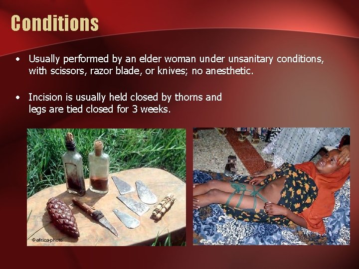 Conditions • Usually performed by an elder woman under unsanitary conditions, with scissors, razor