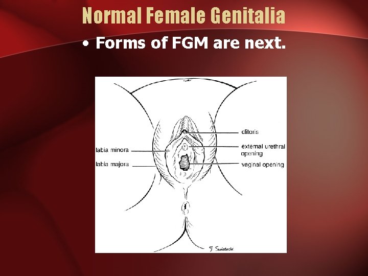 Normal Female Genitalia • Forms of FGM are next. 