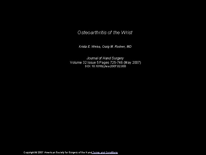 Osteoarthritis of the Wrist Krista E. Weiss, Craig M. Rodner, MD Journal of Hand