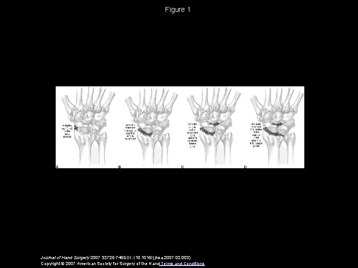 Figure 1 Journal of Hand Surgery 2007 32725 -746 DOI: (10. 1016/j. jhsa. 2007.