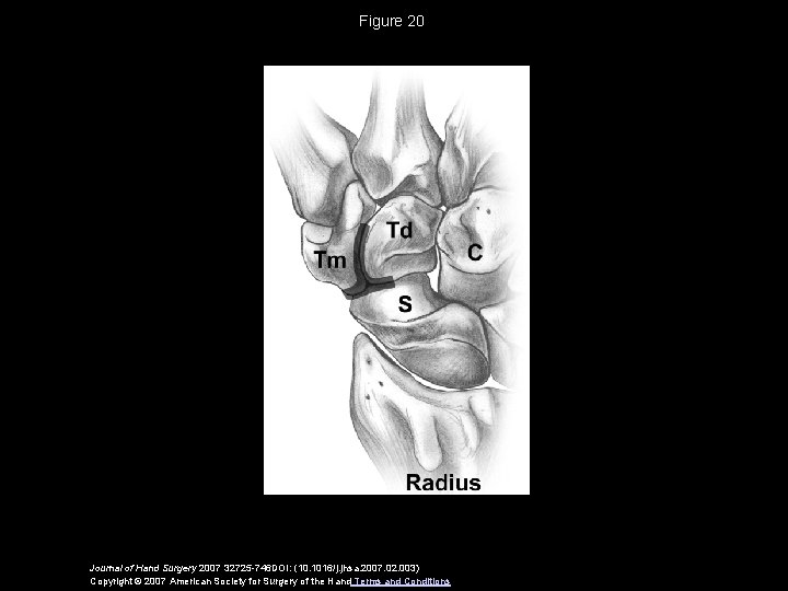 Figure 20 Journal of Hand Surgery 2007 32725 -746 DOI: (10. 1016/j. jhsa. 2007.