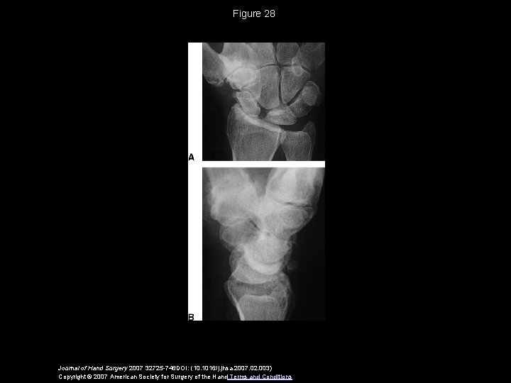 Figure 28 Journal of Hand Surgery 2007 32725 -746 DOI: (10. 1016/j. jhsa. 2007.