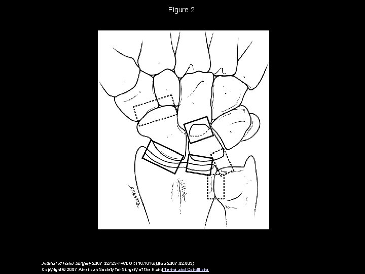 Figure 2 Journal of Hand Surgery 2007 32725 -746 DOI: (10. 1016/j. jhsa. 2007.