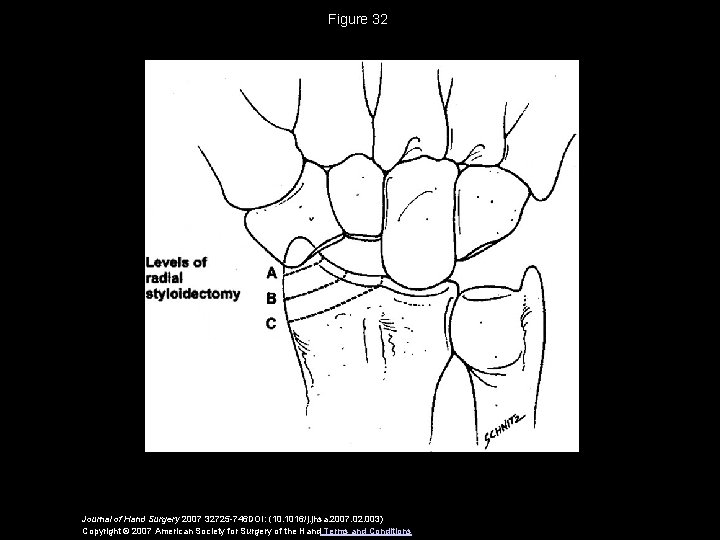 Figure 32 Journal of Hand Surgery 2007 32725 -746 DOI: (10. 1016/j. jhsa. 2007.