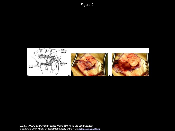 Figure 5 Journal of Hand Surgery 2007 32725 -746 DOI: (10. 1016/j. jhsa. 2007.