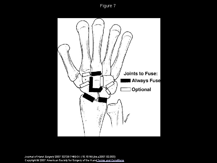 Figure 7 Journal of Hand Surgery 2007 32725 -746 DOI: (10. 1016/j. jhsa. 2007.