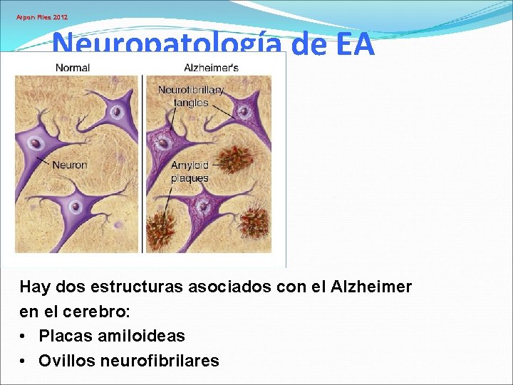 Arpon Files 2012 Neuropatología de EA Hay dos estructuras asociados con el Alzheimer en