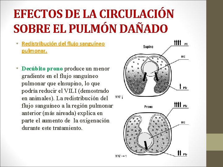 EFECTOS DE LA CIRCULACIÓN SOBRE EL PULMÓN DAÑADO • Redistribución del flujo sanguíneo pulmonar.