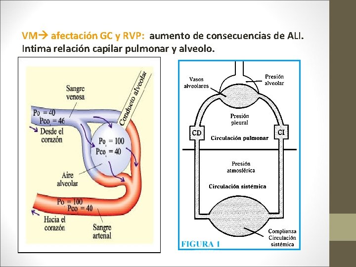 VM afectación GC y RVP: aumento de consecuencias de ALI. Intima relación capilar pulmonar