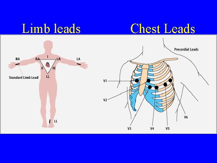 Limb leads Chest Leads 