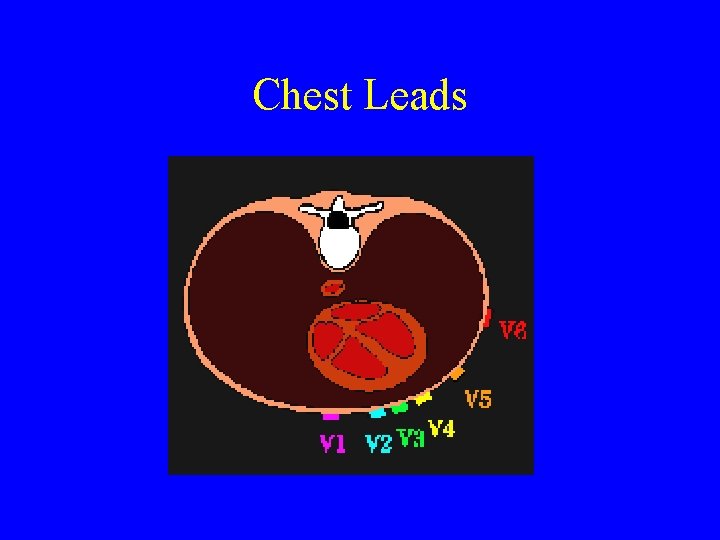 Chest Leads 