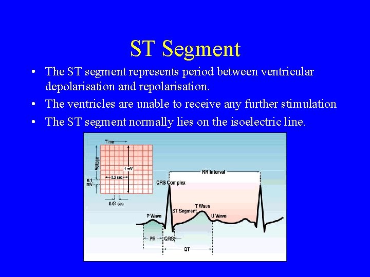 ST Segment • The ST segment represents period between ventricular depolarisation and repolarisation. •