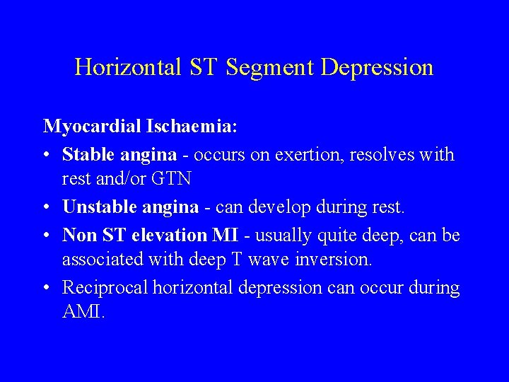 Horizontal ST Segment Depression Myocardial Ischaemia: • Stable angina - occurs on exertion, resolves