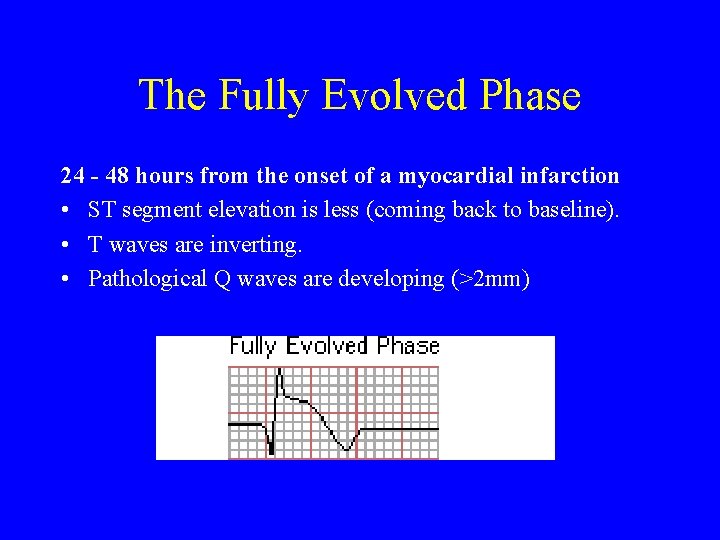 The Fully Evolved Phase 24 - 48 hours from the onset of a myocardial