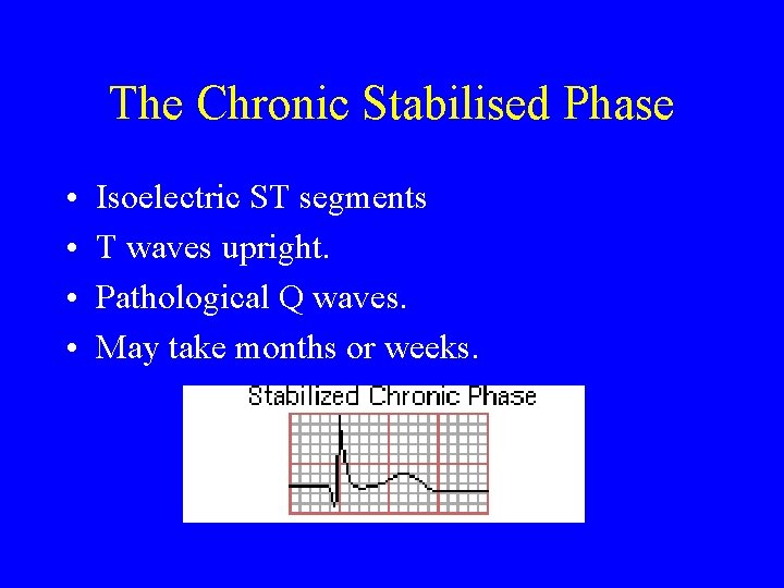 The Chronic Stabilised Phase • • Isoelectric ST segments T waves upright. Pathological Q