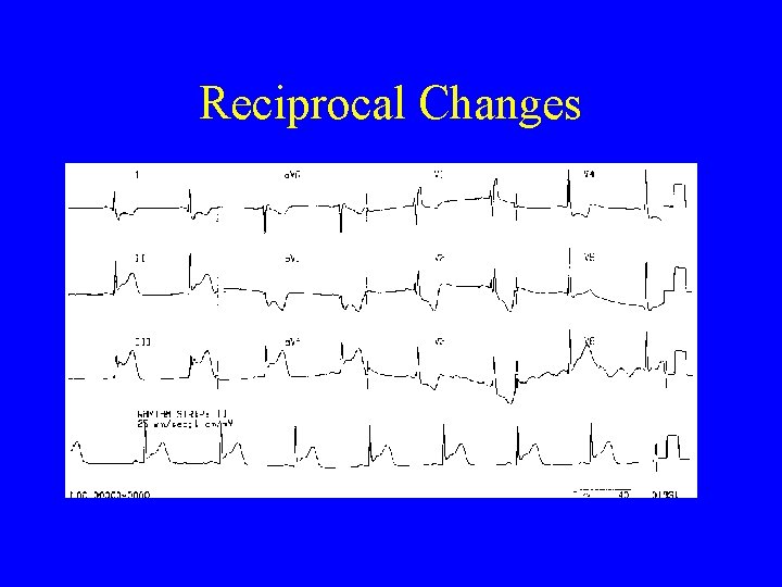 Reciprocal Changes 