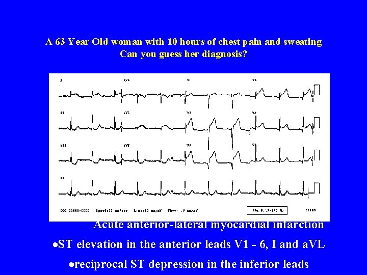 A 63 Year Old woman with 10 hours of chest pain and sweating Can