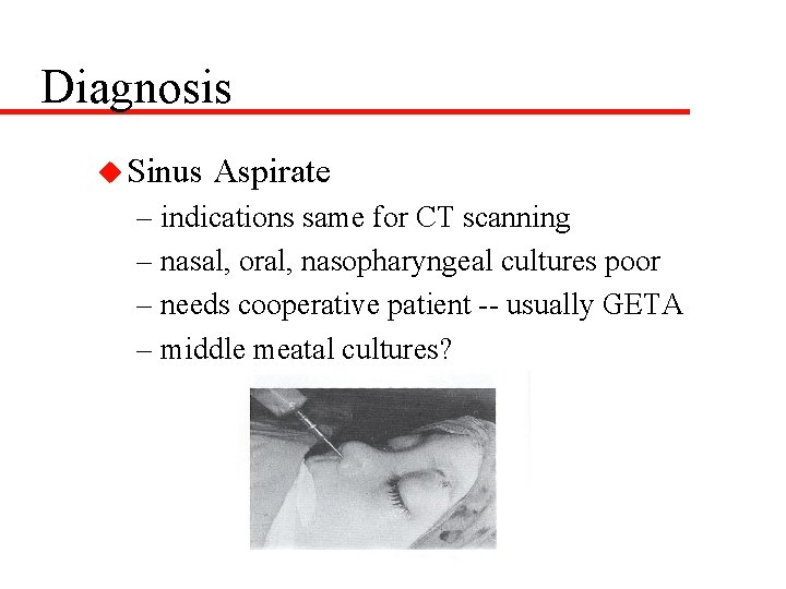 Diagnosis u Sinus Aspirate – indications same for CT scanning – nasal, oral, nasopharyngeal