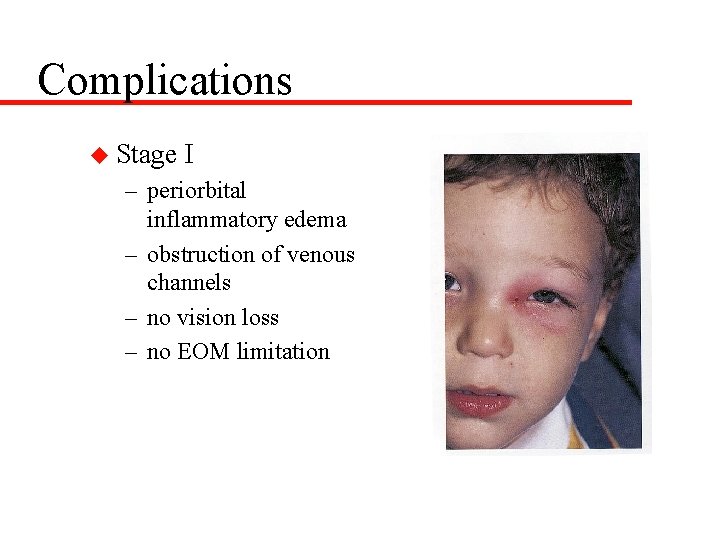 Complications u Stage I – periorbital inflammatory edema – obstruction of venous channels –