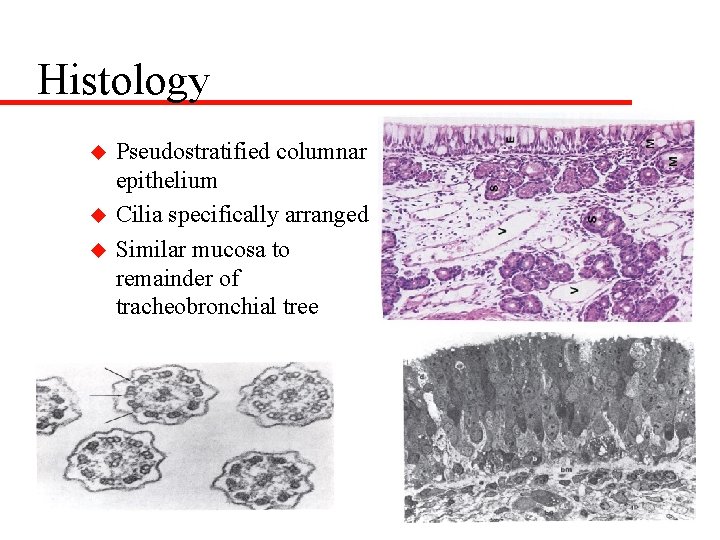 Histology u u u Pseudostratified columnar epithelium Cilia specifically arranged Similar mucosa to remainder