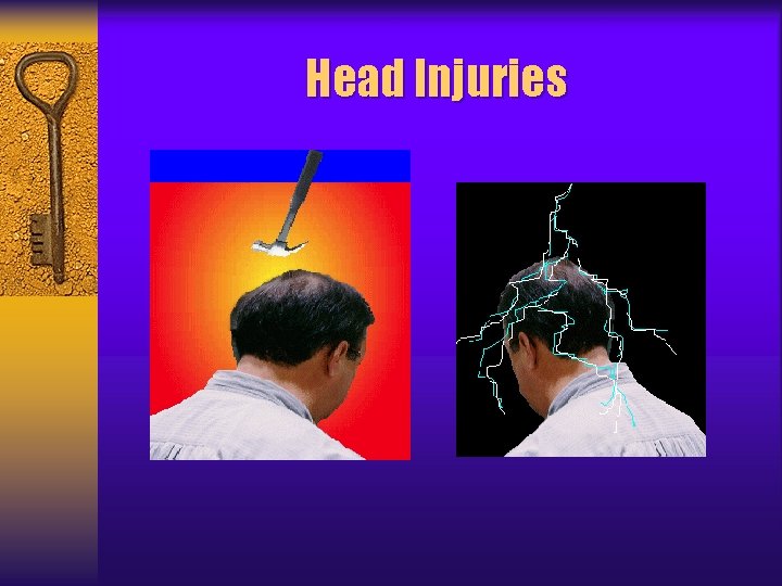 Head Injuries 