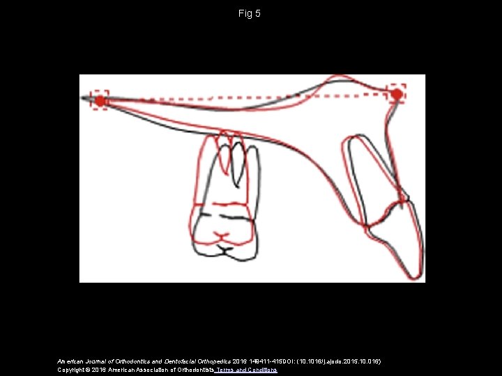 Fig 5 American Journal of Orthodontics and Dentofacial Orthopedics 2016 149411 -415 DOI: (10.