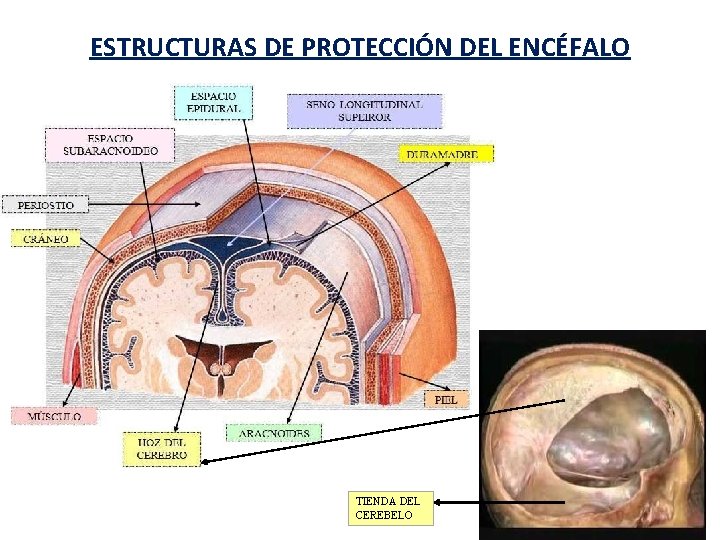 ESTRUCTURAS DE PROTECCIÓN DEL ENCÉFALO TIENDA DEL CEREBELO 