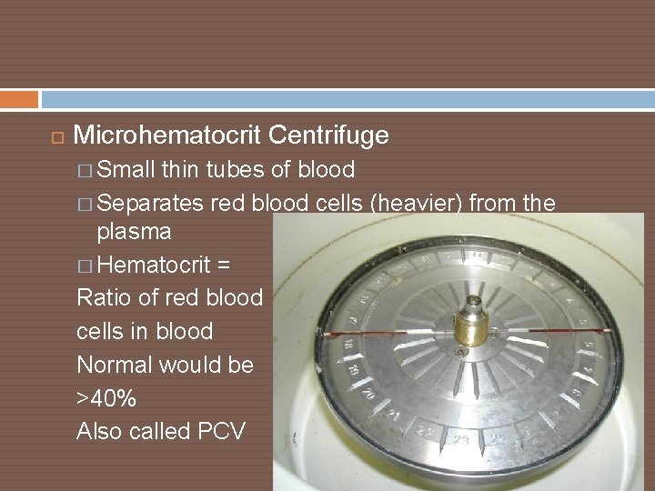  Microhematocrit Centrifuge � Small thin tubes of blood � Separates red blood cells