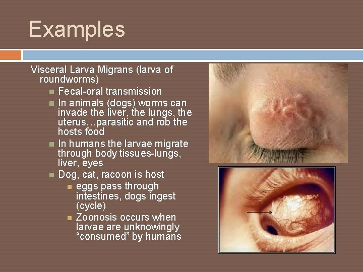 Examples Visceral Larva Migrans (larva of roundworms) Fecal-oral transmission In animals (dogs) worms can