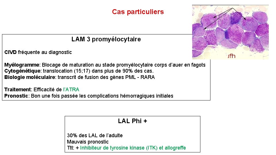 Cas particuliers LAM 3 promyélocytaire CIVD fréquente au diagnostic Myélogramme: Blocage de maturation au