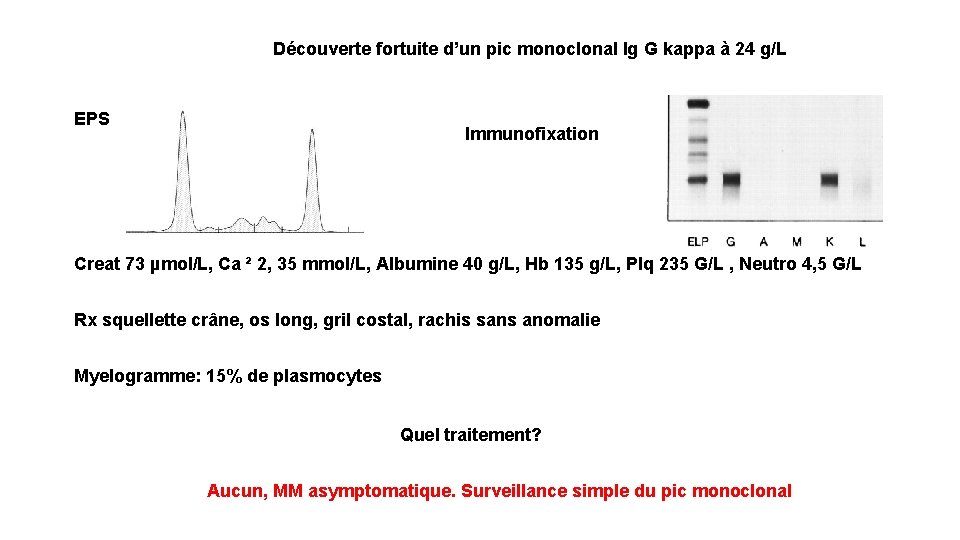 Découverte fortuite d’un pic monoclonal Ig G kappa à 24 g/L EPS Immunofixation Creat
